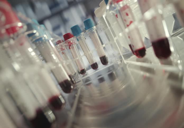 Close-up of blood samples in test tubes spinning in a centrifuge in a modern medical laboratory