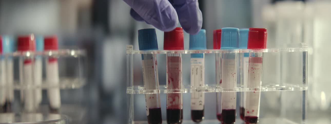 A lab technician in gloves carefully places a blood sample in a test tube rack for analysis