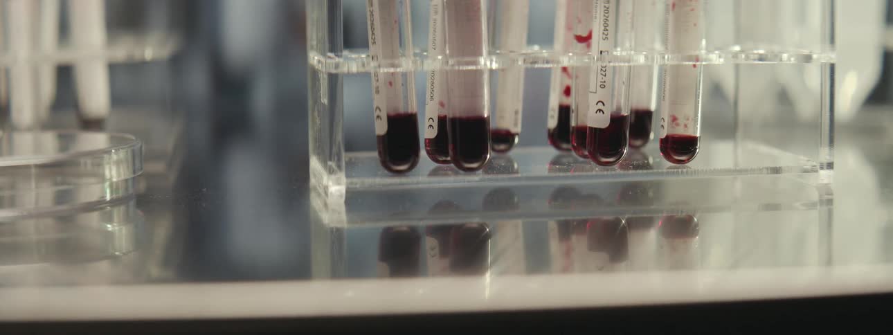 A slow zoom out from a close-up of blood samples in test tubes sitting in a rack within a modern medical laboratory