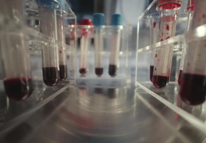 Dolly shot travels through rows of test tubes containing blood samples on a metal table in a clinical laboratory