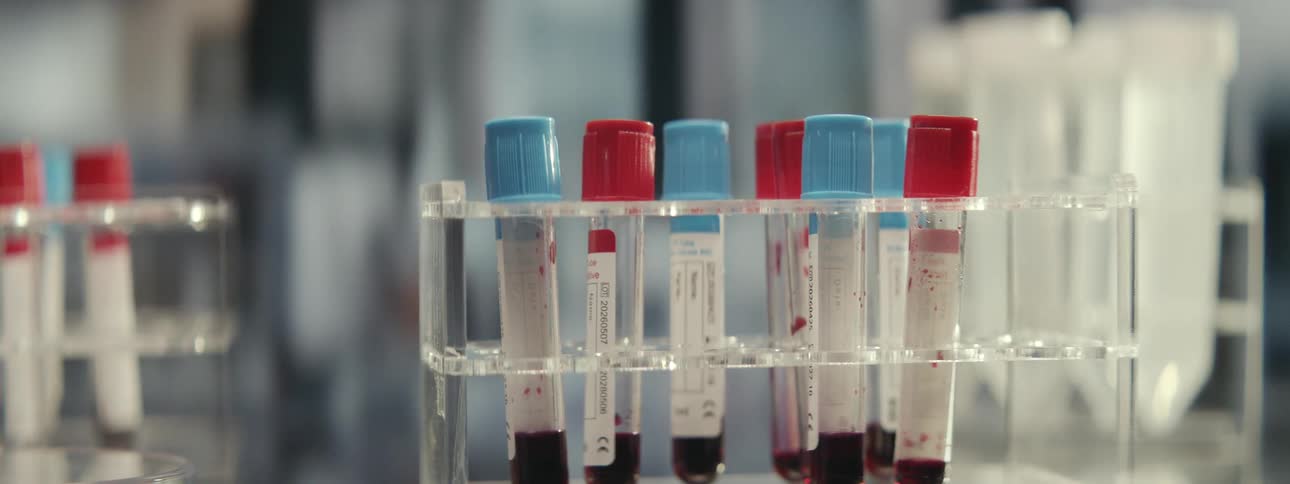 In slow motion, a gloved scientist carefully selects and examines a vial of blood from a test tube rack in a laboratory