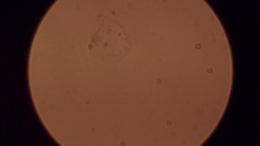 Vintage microscopic footage of a single-celled organism floating in liquid zooms out to resemble an out-of-focus moon