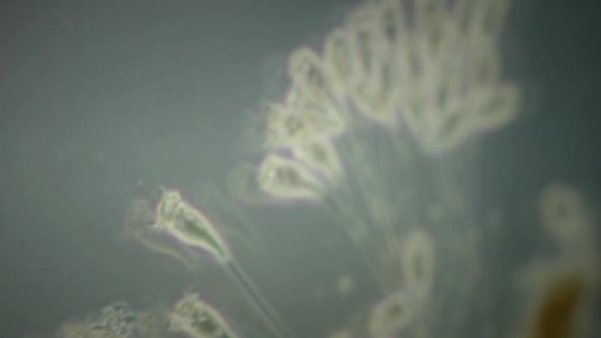 A fascinating microscopic view of various microorganisms, including Vorticella ciliates and amoebas, teeming in a liquid medium