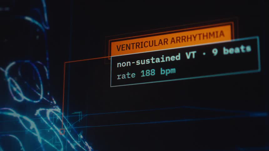 Close up on a futuristic medical screen displaying a diagnosis of ventricular arrhythmia