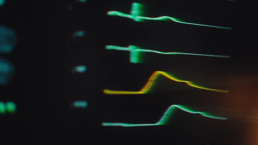 Dramatic close-up of a hospital monitor displays a patient's pulsing vital signs with digital distortion on a dark screen