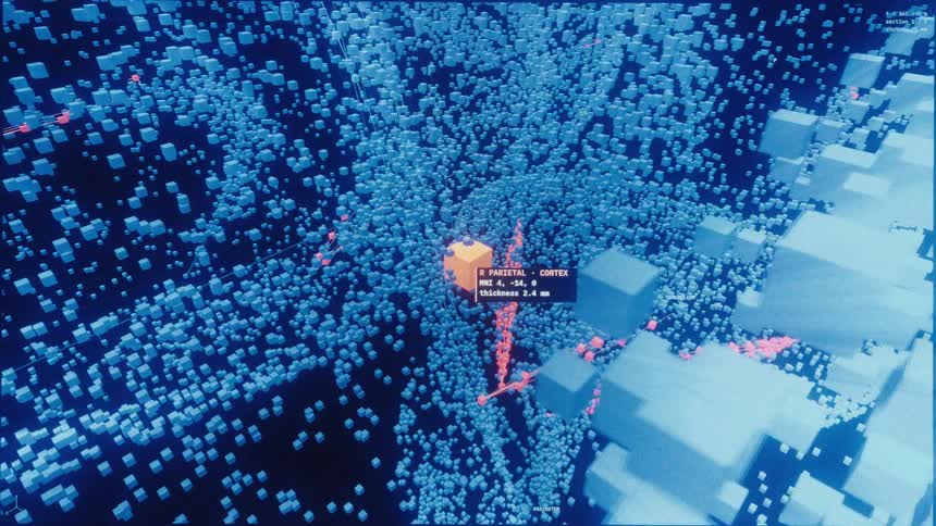 Advanced medical software performs a detailed analysis of a human brain, represented by glowing digital particles and voxels
