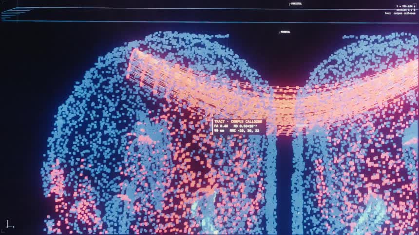 A detailed 3D digital model of a human brain is analyzed on a futuristic interface, showing neural activity with glowing particles