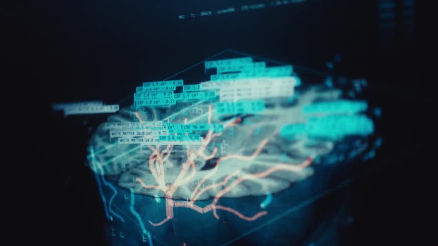 Futuristic medical interface displays a rotating human brain scan with advanced data analysis and highlighted blood vessels