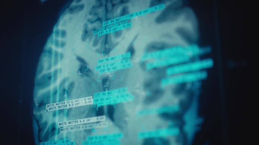 Advanced medical interface displays a moving MRI scan of a human brain with data overlays for diagnostics