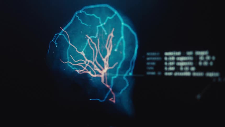 A futuristic digital interface displays a flickering medical scan of the vascular system within a human brain