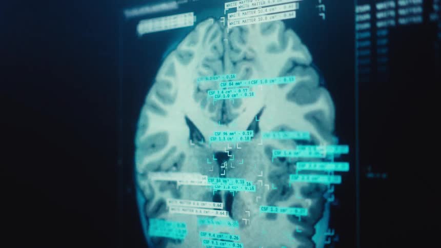 Advanced medical software performs a detailed analysis of a human brain scan on a futuristic digital display