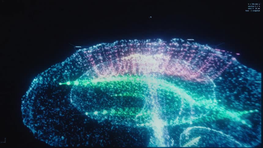 A detailed and futuristic data visualization of a human brain scan, showing neural activity with colorful glowing particles