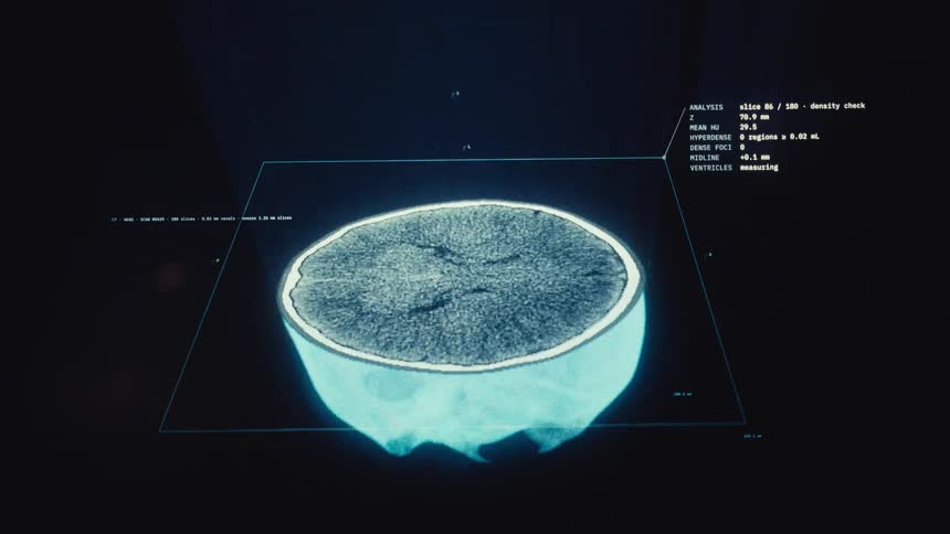 A futuristic medical interface displays a detailed CT scan, progressively revealing cross-sectional slices of a human brain and skull