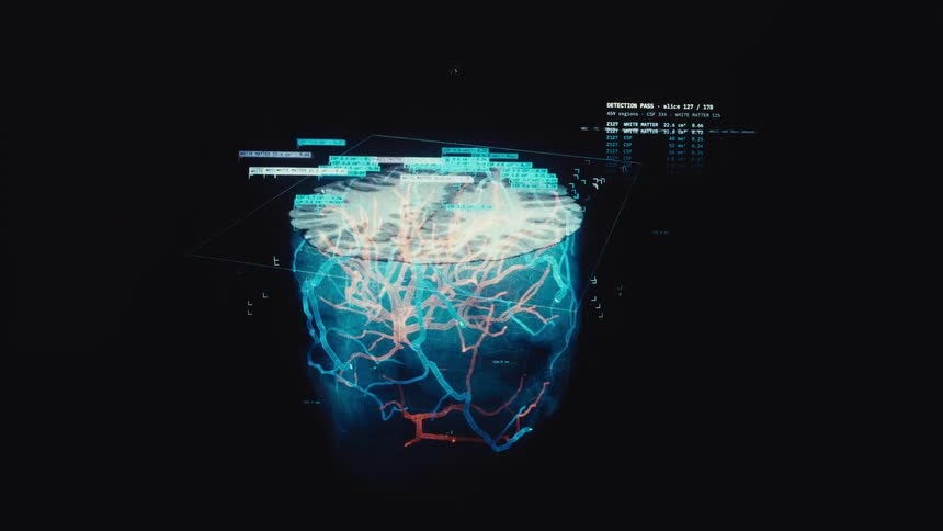 A futuristic medical interface performs a detailed 3D scan and analysis of the human brain's vascular system