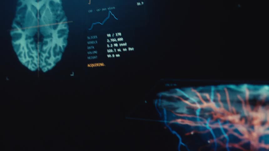 Advanced medical software performs a detailed CT scan of a human head, revealing a complete 3D model of the brain and its vascular system