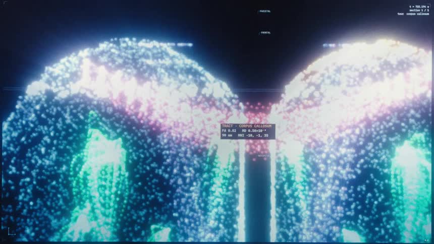 Futuristic digital animation of a colorful and glitchy 3D human brain scan with complex data readouts