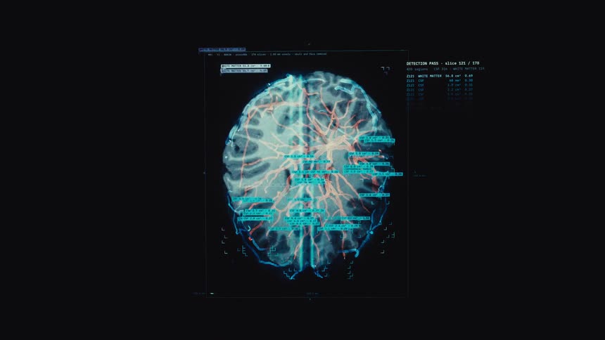 A high-tech digital interface performs a detailed scan and analysis of the human brain's circulatory system and structure