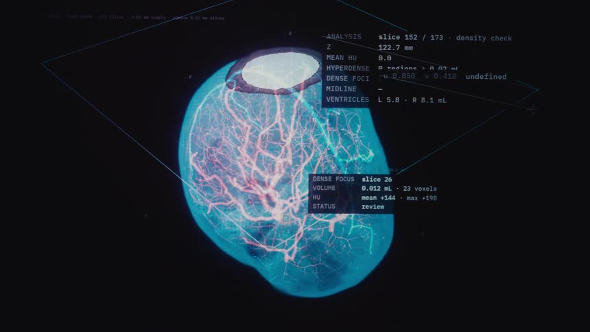 A futuristic medical interface displays a detailed CT scan analysis of a human brain, highlighting the complex network of blood vessels