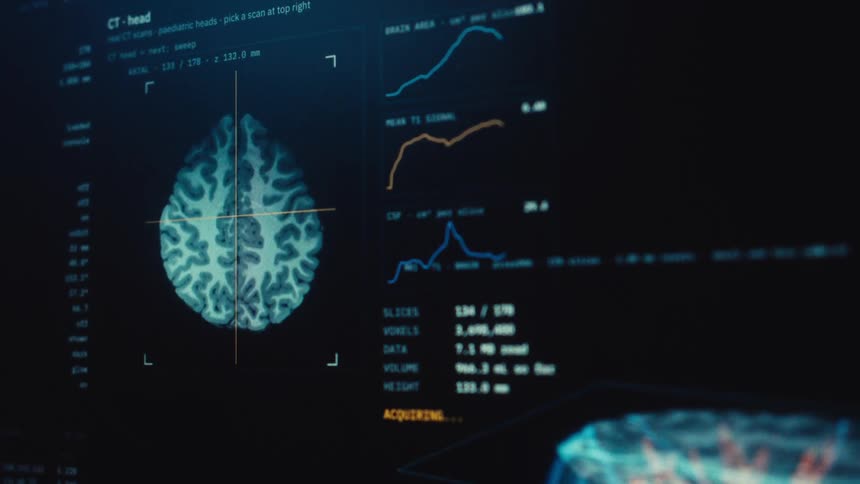 Close-up of a futuristic medical display showing the data acquisition process and detailed 3D rendering of a human brain and its vascular system