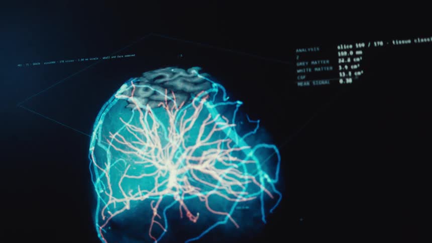 A futuristic medical interface displays a detailed 3D brain scan with highlighted blood vessels and real-time diagnostic data analysis