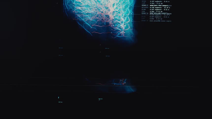 A futuristic medical display shows a 3D rendering of the human brain's vascular system, rotating and zooming in for detailed analysis