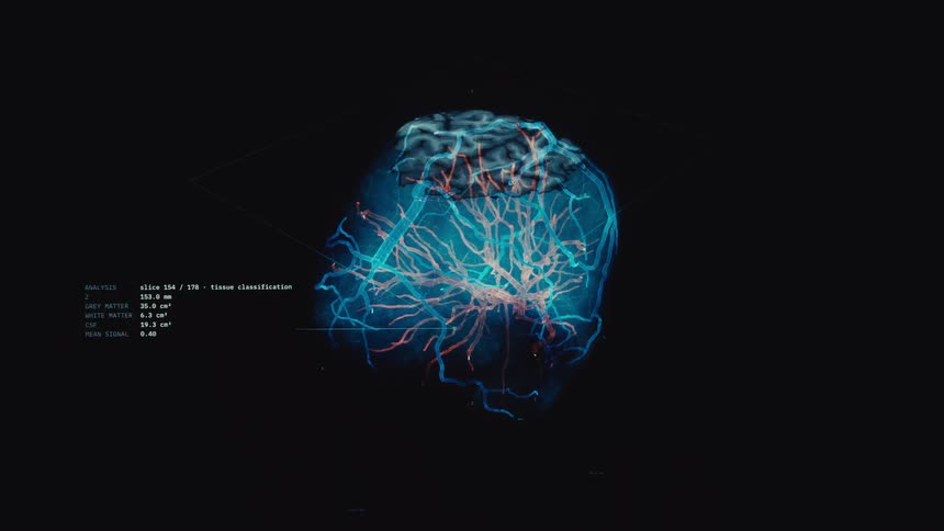 Futuristic medical interface displays a detailed 3D rendering of a human brain scan with tissue and vascular analysis