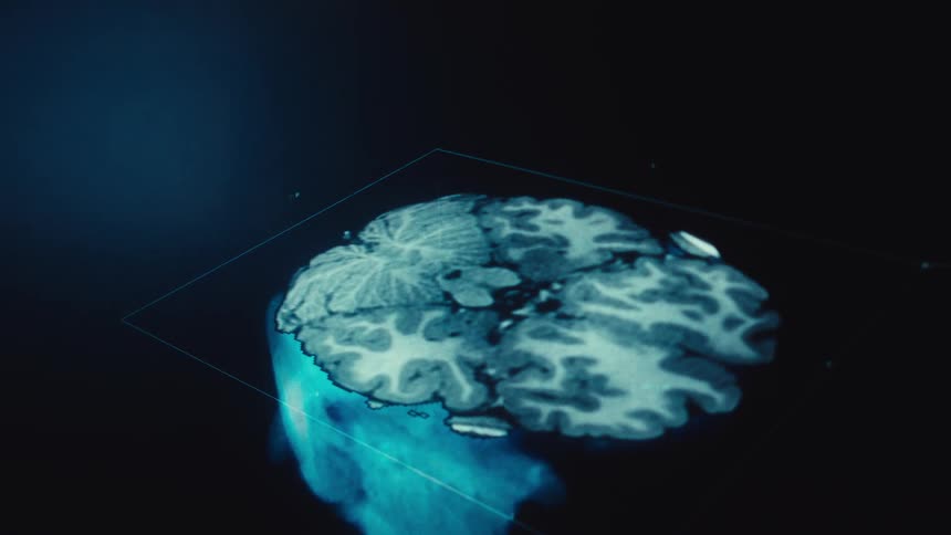 A futuristic medical interface displays an animated 3D model and cross-sections of a human brain scan