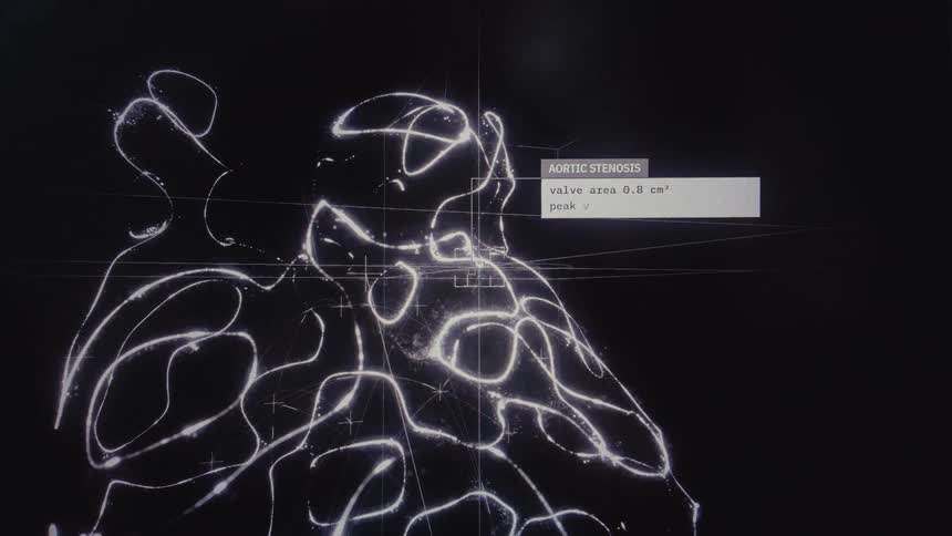 Futuristic medical interface displays patient data, predicting heart disease risk and diagnosing aortic stenosis from an ECG scan