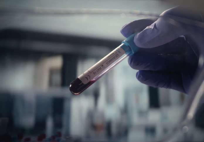 A scientist in purple gloves carefully inspects a vial of blood in a modern medical laboratory