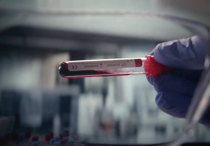A scientist in a sterile lab holds up and examines a test tube filled with a blood sample