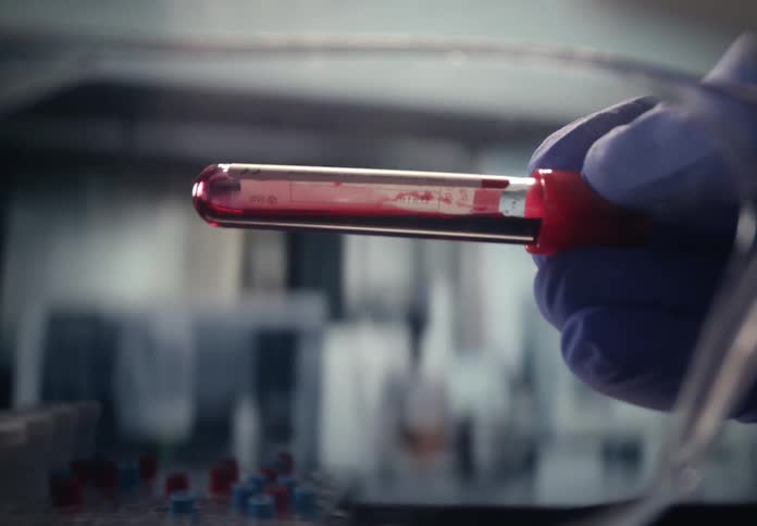 A medical professional in protective gloves carefully inspects a blood sample in a test tube within a modern laboratory