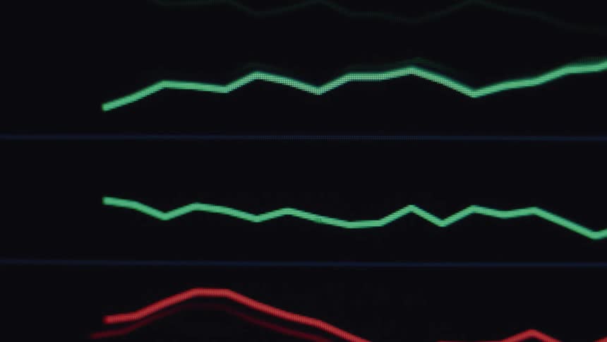 A close-up shot of a medical monitor displays green and red lines indicating a patient's vital signs