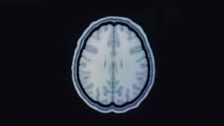 A detailed, animated MRI scan progressively reveals the cross-sections of a human brain from top to bottom