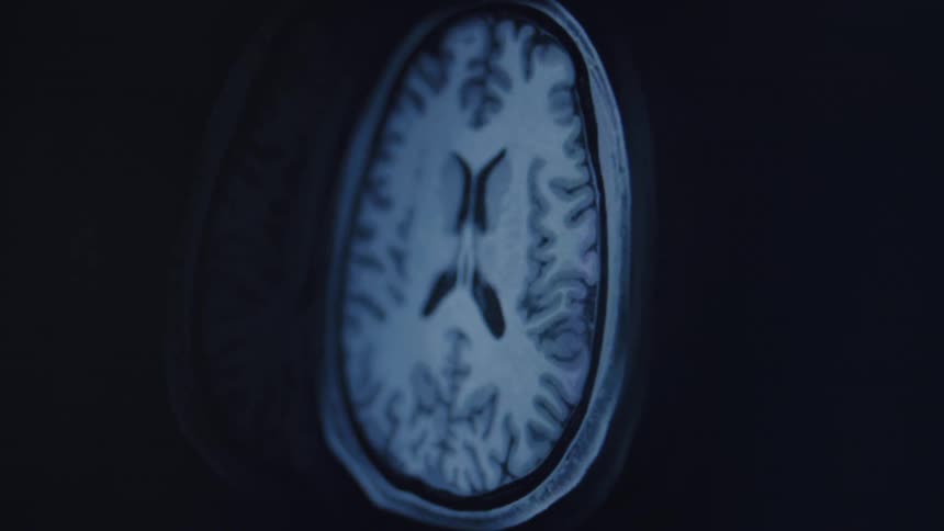 A close-up of a digital human brain MRI scan showing multiple anatomical cross-sections for medical diagnostics