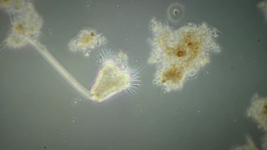 Microscopic view of a Vorticella ciliate protozoan attached by its contractile stalk among other microorganisms in pond water