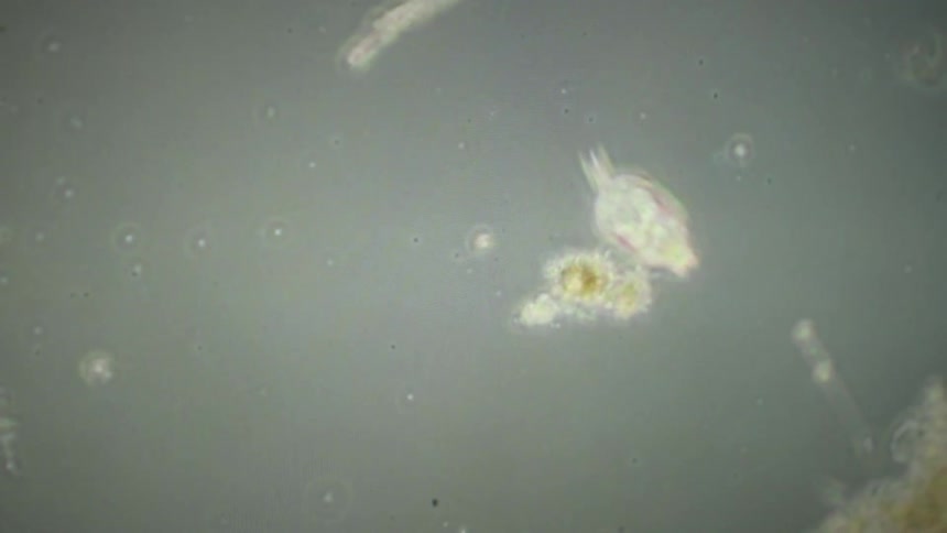 A microscopic view of a stalked ciliate protozoan, likely Vorticella, feeding in a drop of murky water