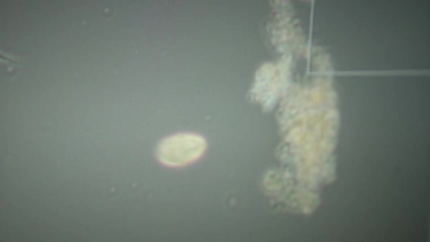 A microscopic close-up shows a single-celled protozoan swimming through liquid