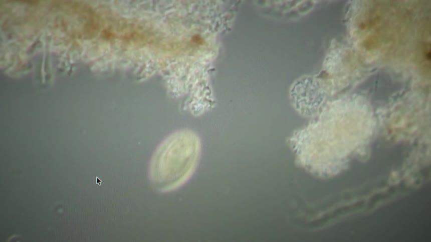 A microscopic view of various single-celled protozoa swimming and interacting in a liquid medium