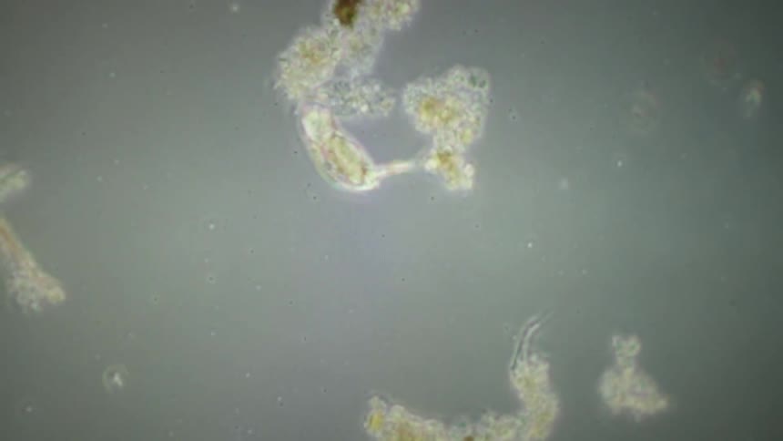 A microscopic view of a rotifer attached to a microbial floc in pond water