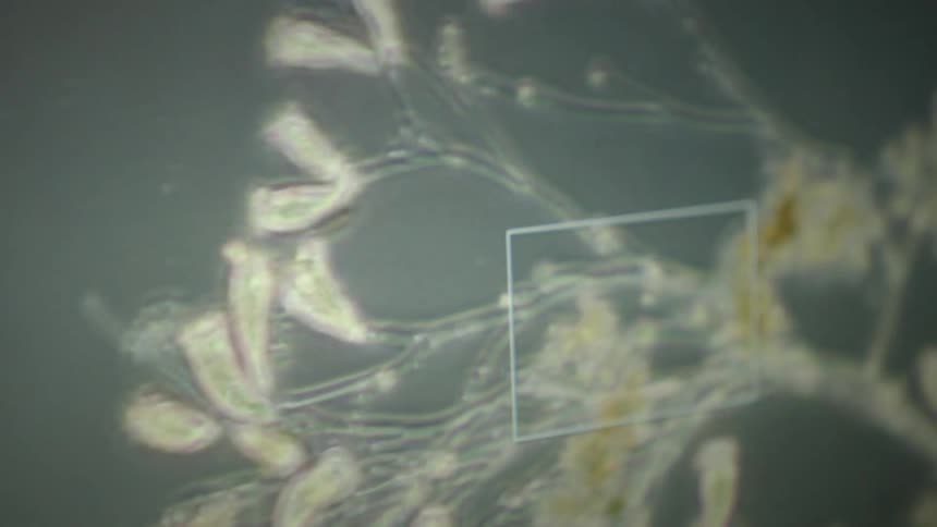 A microscopic view of Vorticella microorganisms attached to stalks and moving in a liquid environment