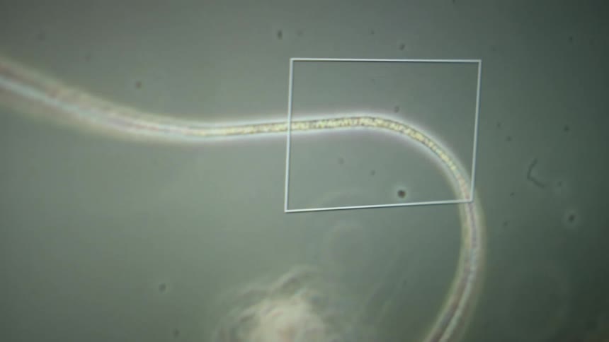 A close-up view through a microscope reveals a filamentous microorganism, likely bacteria, under analysis