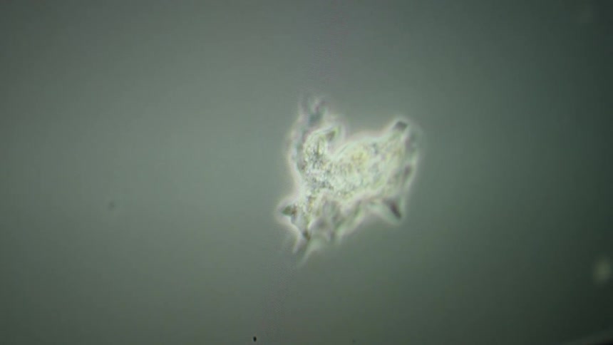 A fascinating microscopic view of a single-celled amoeba extending its pseudopods in a murky liquid