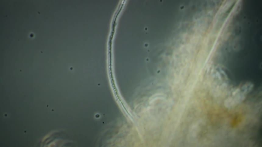 Under the microscope, a long, segmented filament of cyanobacteria slowly drifts past other microorganisms