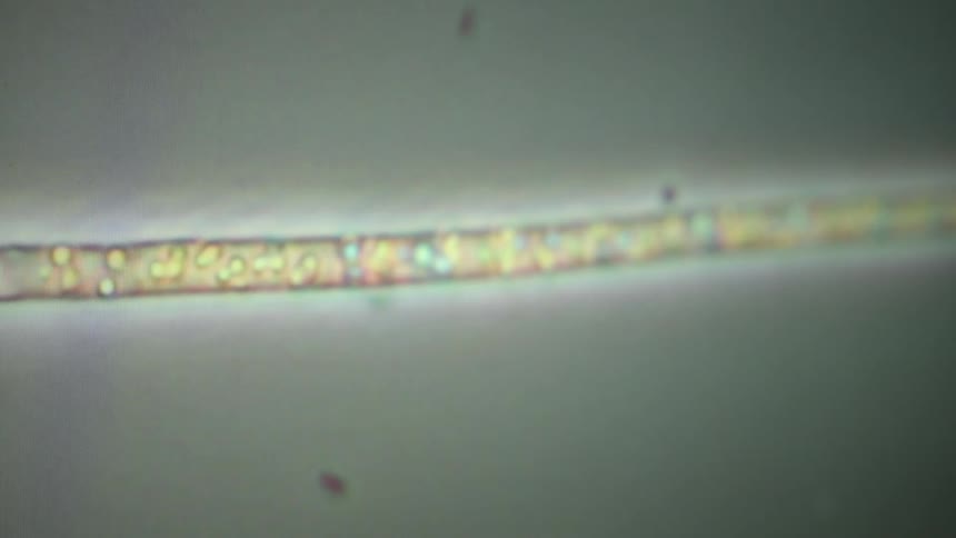 A microscopic view of a single filament of filamentous algae, showing the internal flow of cytoplasm and organelles