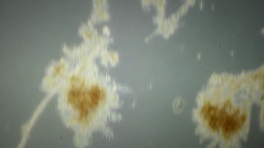 Microscopic view of various protozoa, amoebas, and other microorganisms moving in a drop of water