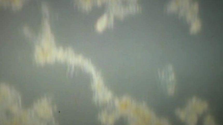 A microscopic view reveals various protozoa, amoebas, and other microorganisms moving through a liquid medium