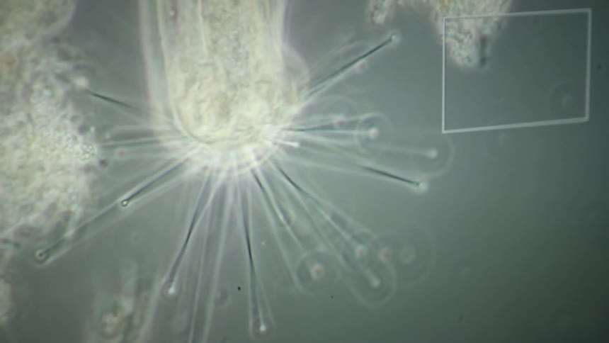 A microscopic close-up reveals a suctorian protozoan, a single-celled predator, extending its radial tentacles to capture prey