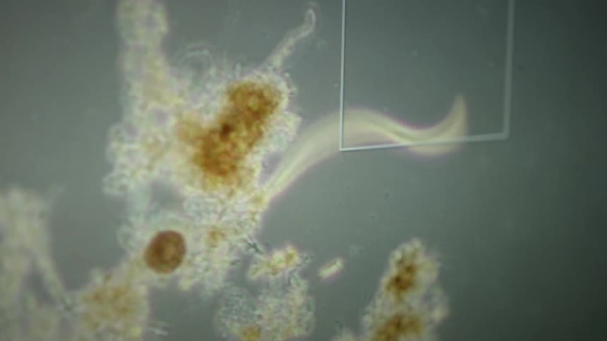 Microscopic view of a tiny nematode worm wiggling and exploring a cluster of bacteria