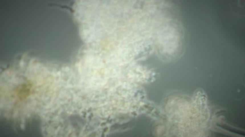 A close-up, microscopic view of a colony of amoebas slowly moving and changing shape