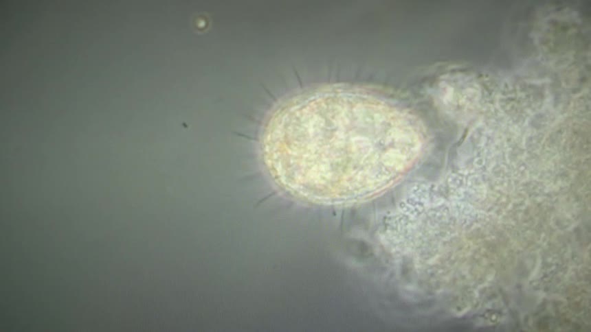 A close-up view through a microscope shows a ciliate protozoan feeding on organic matter